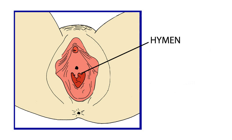A Hylem - Hylem